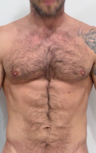 Torse : avant le protocole, exemple individuel